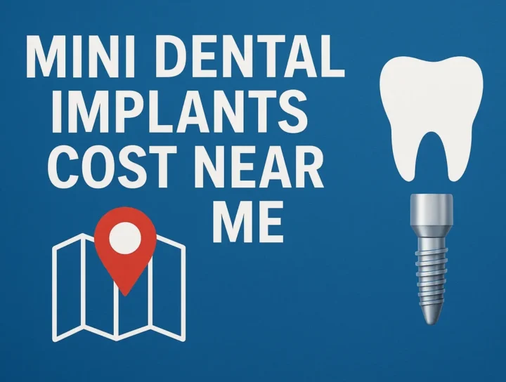Mini Dental Implants Cost Near Me: 2025 Guide to Affordable Smiles 🦷 16 mini dental implants cost near me