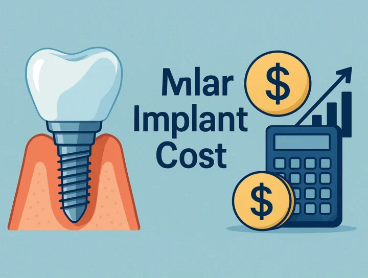 Molar Implant Cost: What You Should Know in 2025 8 molar implant cost
