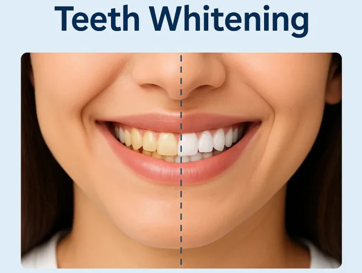 Most Effective Teeth Whitening Methods in 2025 20 most effective teeth whitening