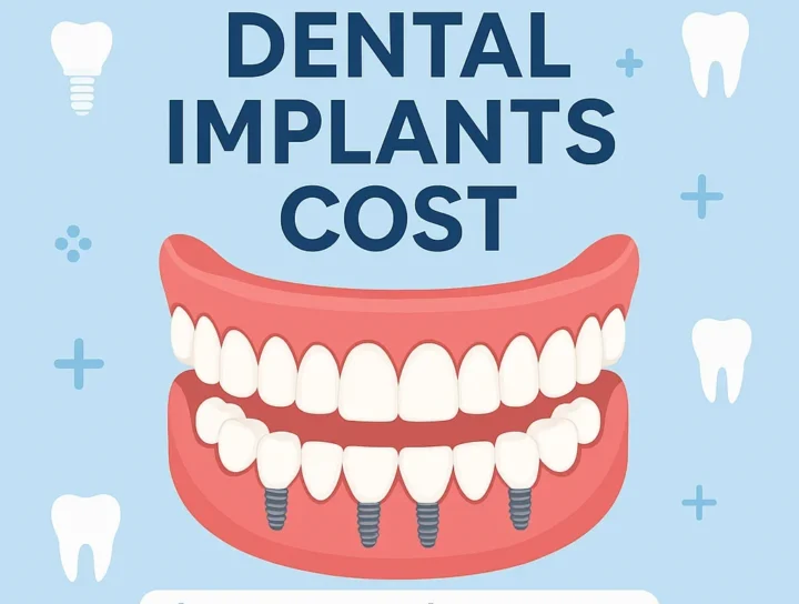 One Day Full Mouth Dental Implants Cost Explained 16 one day full mouth dental implants cost