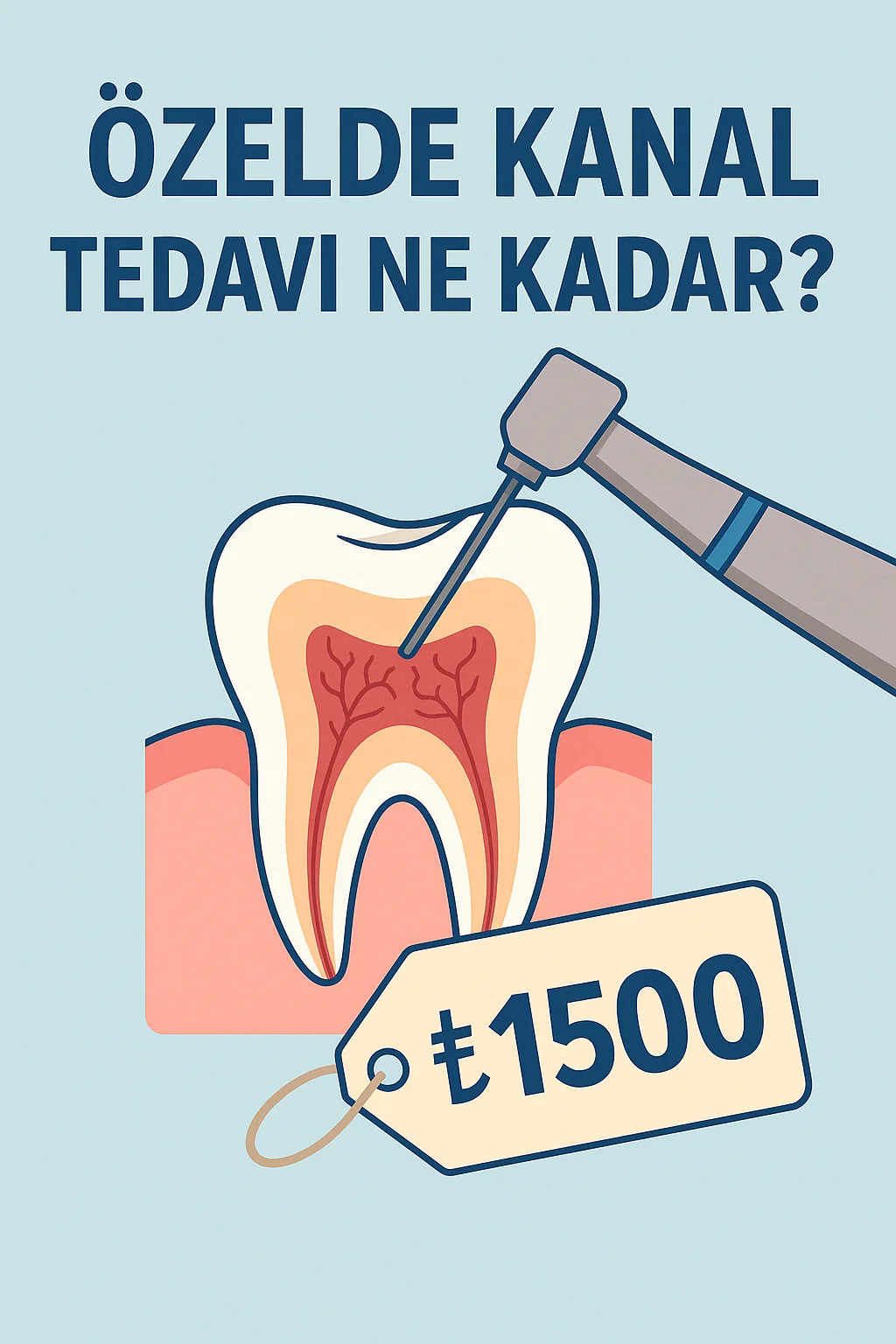 Özelde Kanal Tedavi Ne Kadar? Güncel Fiyatlar ve Detaylar 5 ozelde kanal tedavi ne kadar
