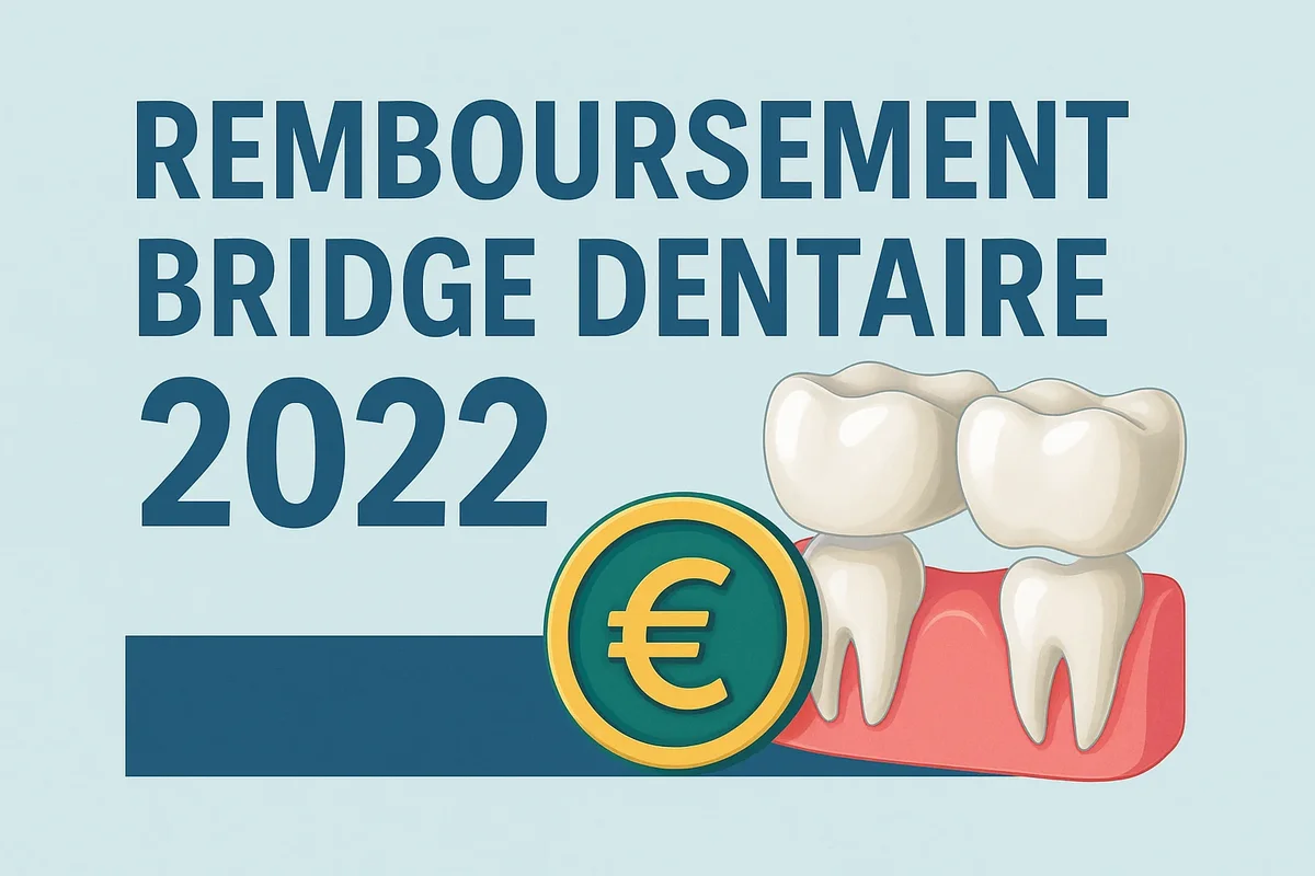 Remboursement bridge dentaire 2022 : guide complet 5 remboursement bridge dentaire 2022