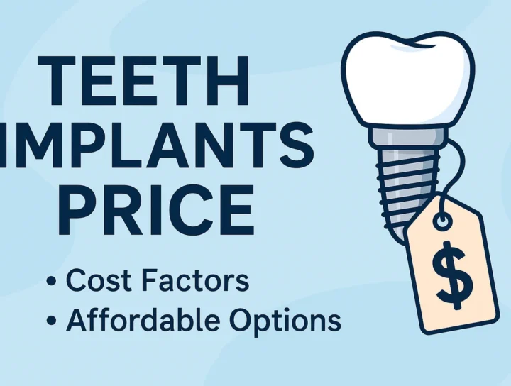 Teeth Implants Price: Full Guide to Cost and Value 4 teeth implants price
