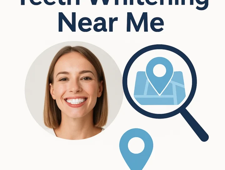 Teeth Whitening Near Me: Your Complete Guide to a Brighter Smile 8 teeth whitening near me
