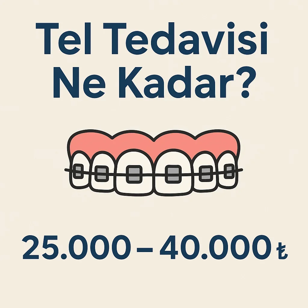 Tel Tedavisi Ne Kadar? 2025 Güncel Diş Teli Fiyatları 5 tel tedavisi ne kadar