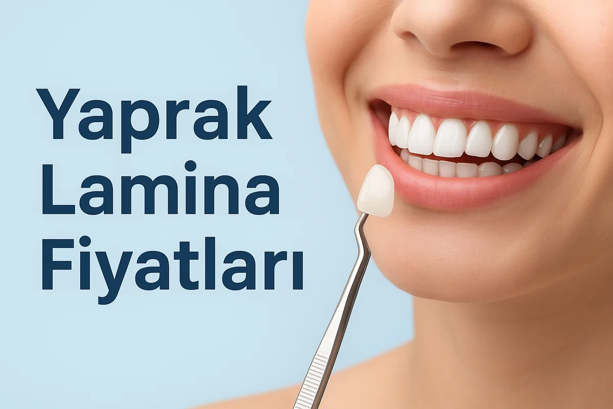 yaprak lamina fiyatlari