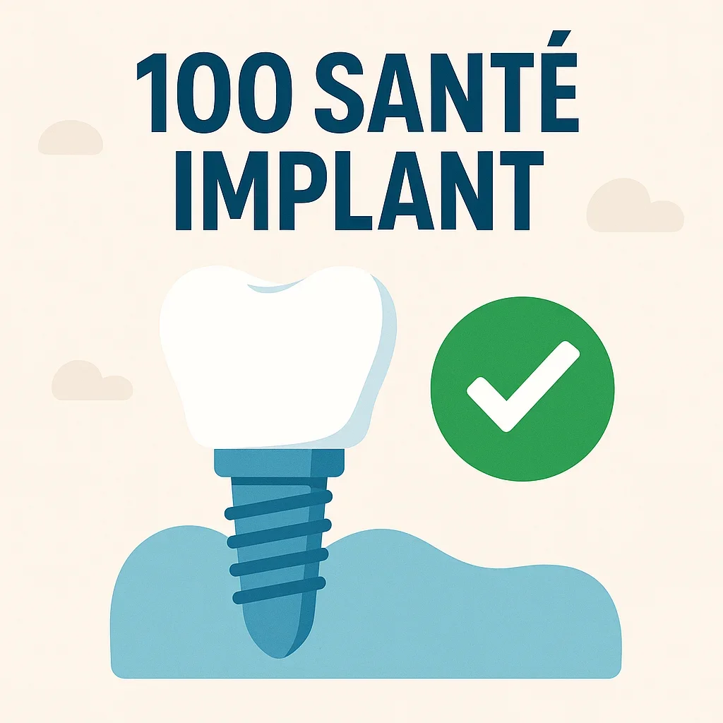 100 santé implant : Guide complet pour un sourire parfait 5 100 santé implant