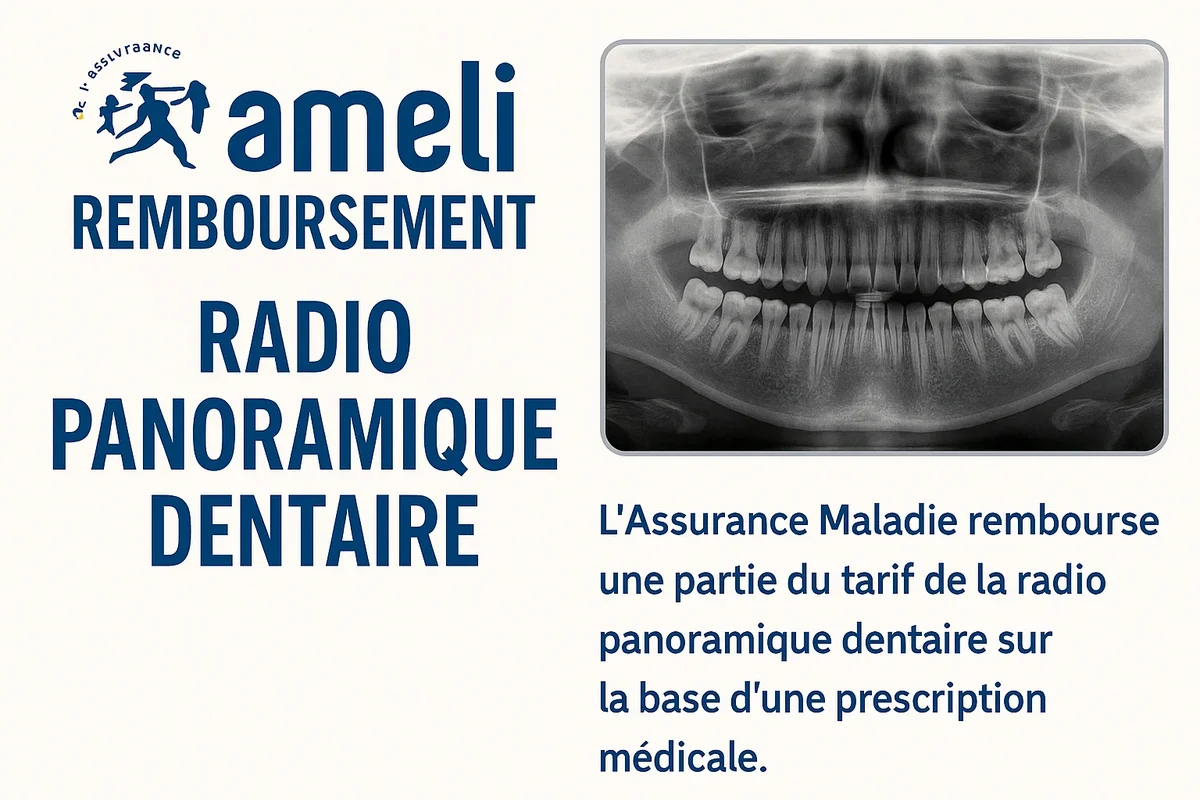 Ameli remboursement radio panoramique dentaire : tout savoir en 2025 5 ameli remboursement radio panoramique dentaire