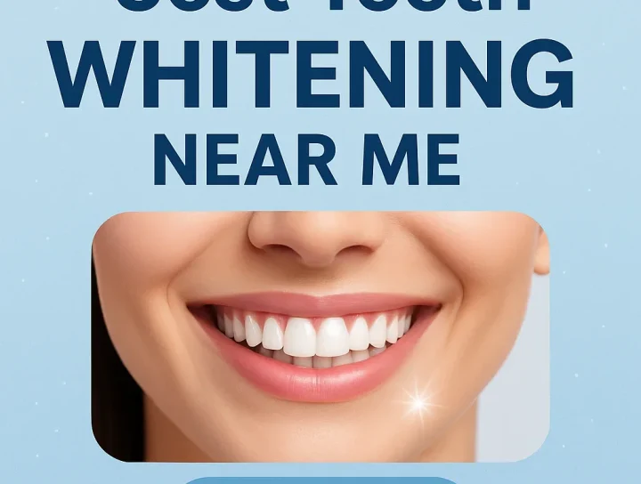 Best Teeth Whitening Near Me: Why Choosing the Right Option Matters 20 best teeth whitening near me