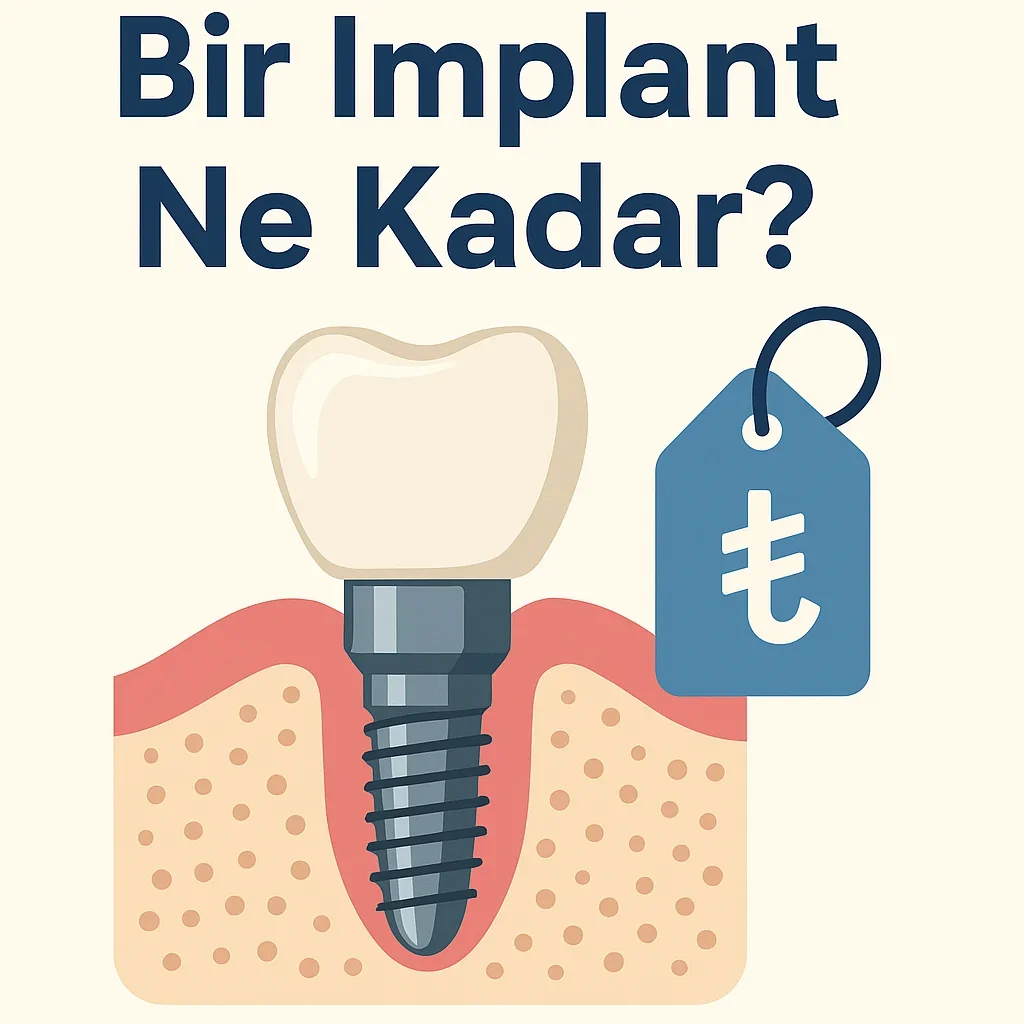 Bir İmplant Ne Kadar? 2025 Güncel Fiyat ve Bilgiler 5 bir implant ne kadar