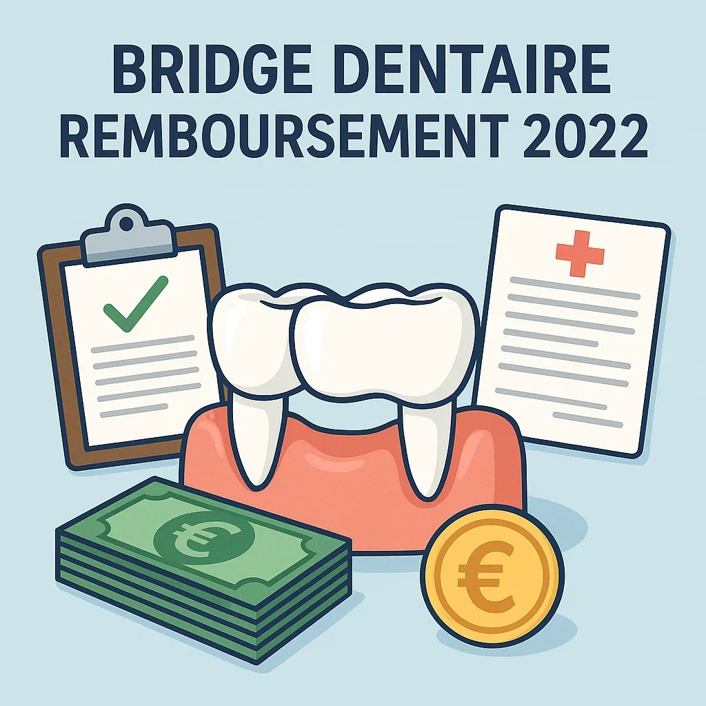 Bridge dentaire remboursement 2022 : Tout savoir en 2025 5 bridge dentaire remboursement 2022
