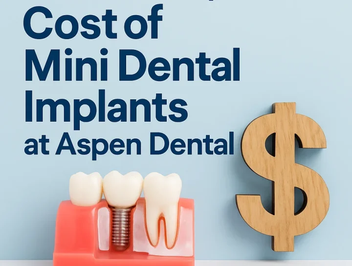 Cost of Mini Dental Implants at Aspen Dental 20 cost of mini dental implants at aspen dental