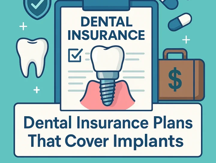 Dental Insurance Plans That Cover Implants 4 dental insurance plans that cover implants
