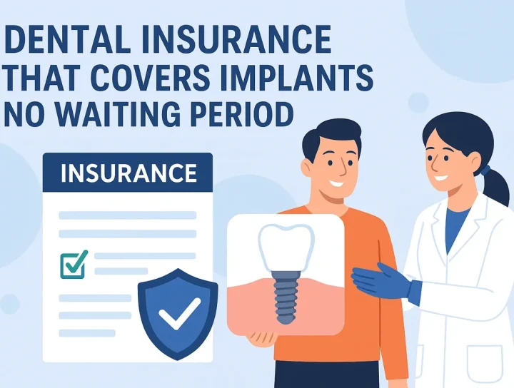 Dental Insurance That Covers Implants No Waiting Period 12 dental insurance that covers implants no waiting period