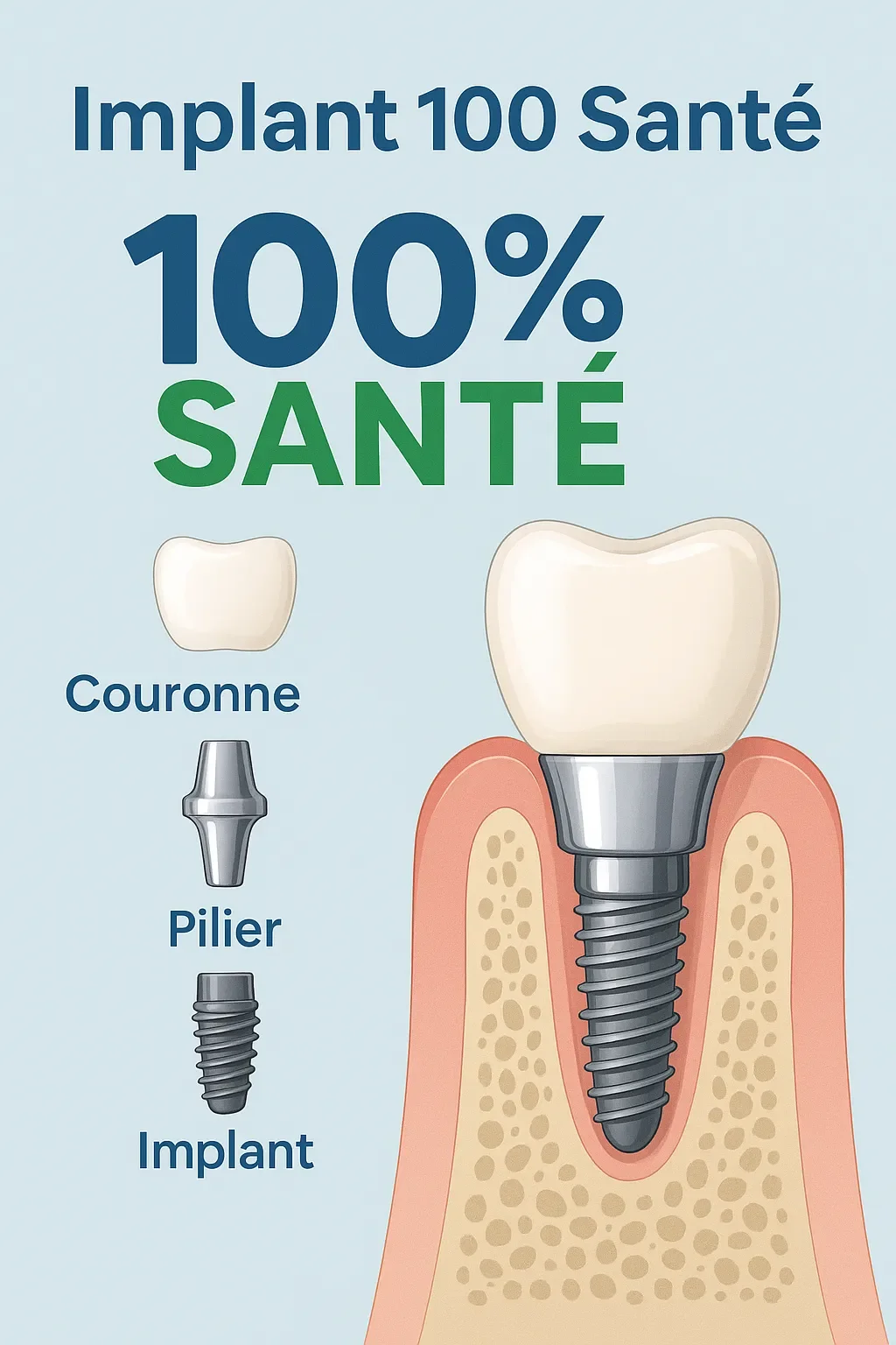 Implant 100 Santé : Tout ce que Vous Devez Savoir 5 implant 100 santé