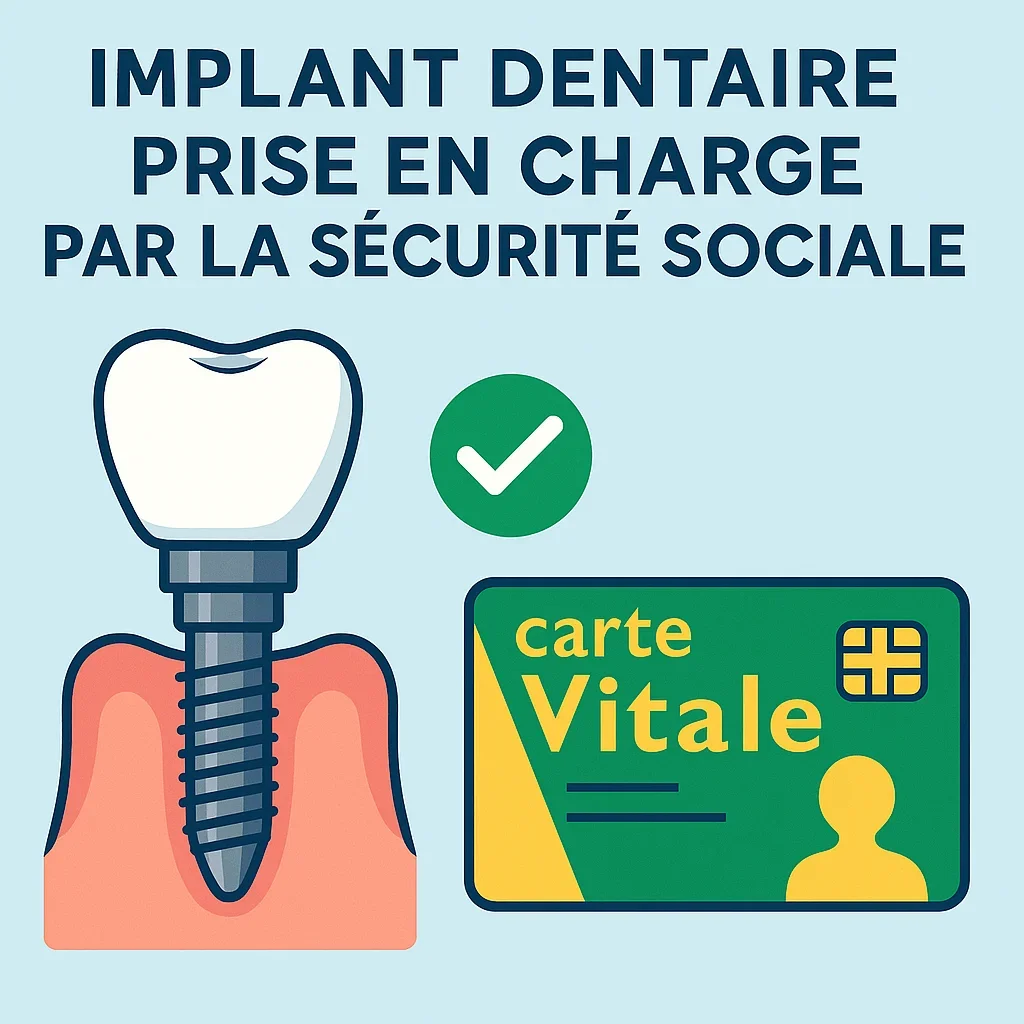 Implant dentaire pris en charge par la sécurité sociale : guide 2025 5 implant dentaire pris en charge par la sécurité sociale