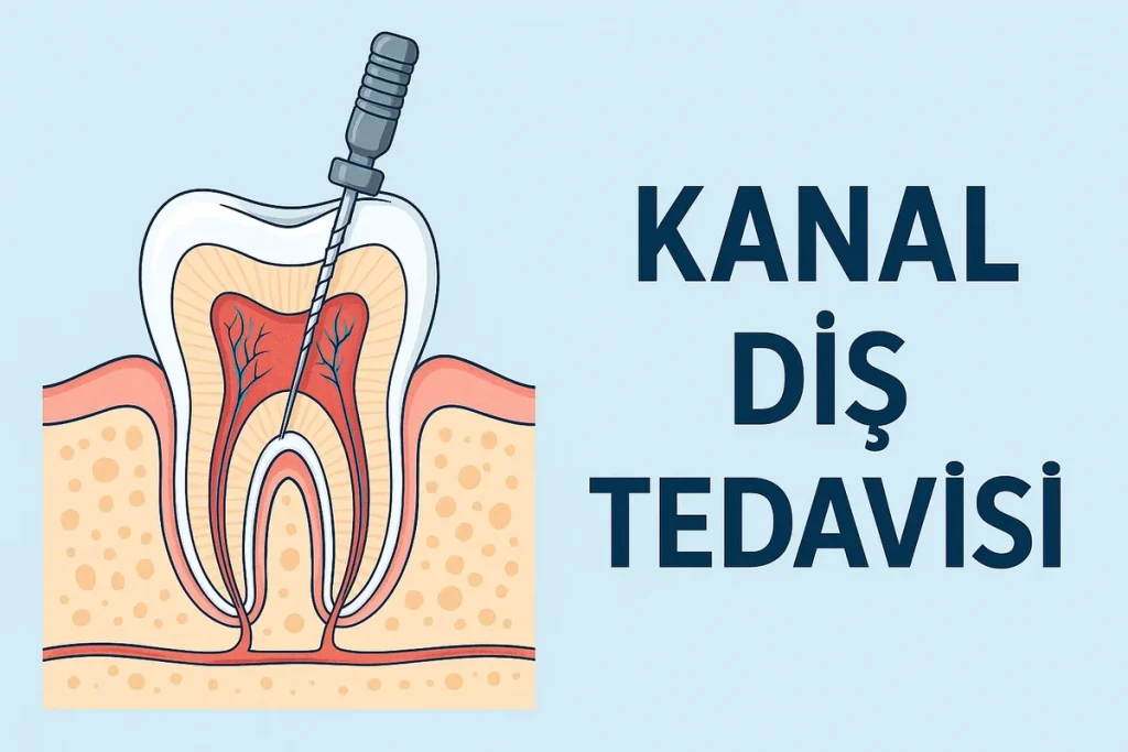 Kanal Diş Tedavisi 2025: Tüm Detaylarıyla Rehber 4 kanal dis tedavisi