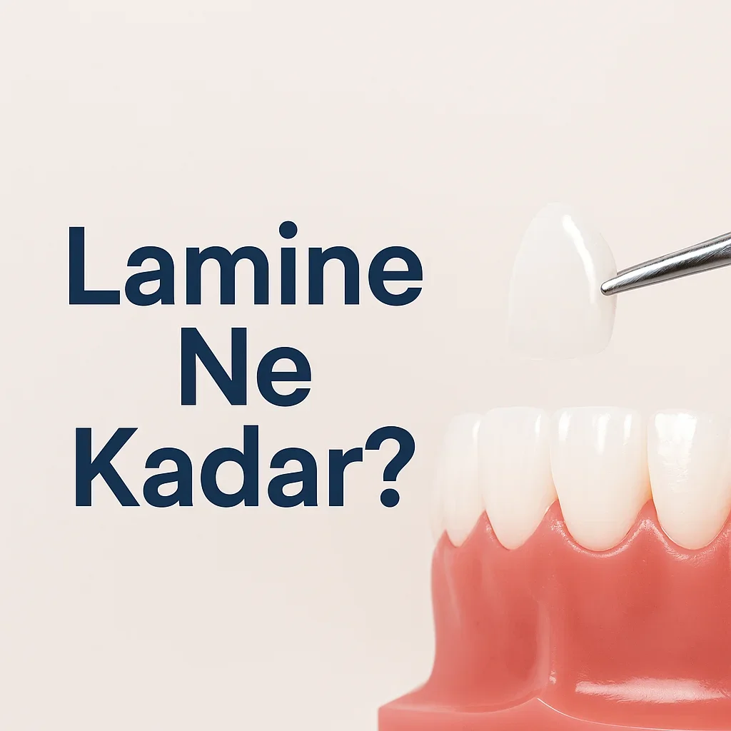 2025 Lamine Ne Kadar? Güncel Fiyat Rehberi 5 lamine ne kadar