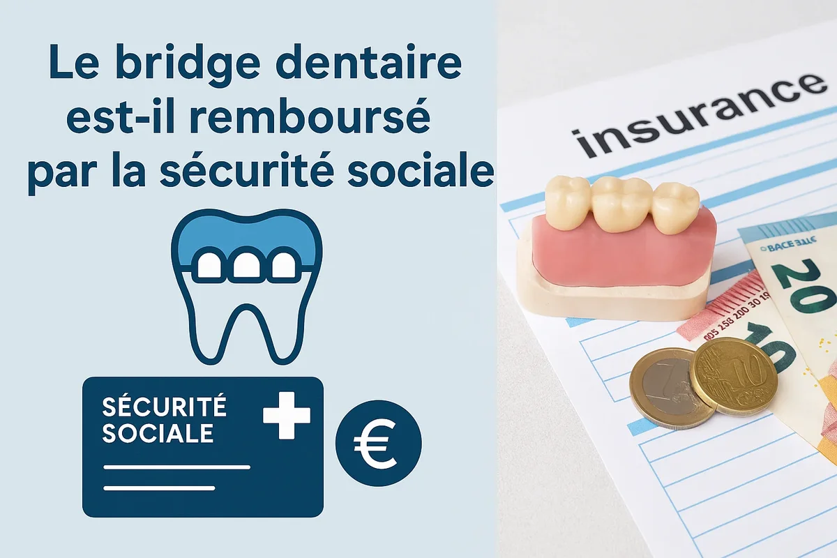 le bridge dentaire est il rembourse par la securite sociale