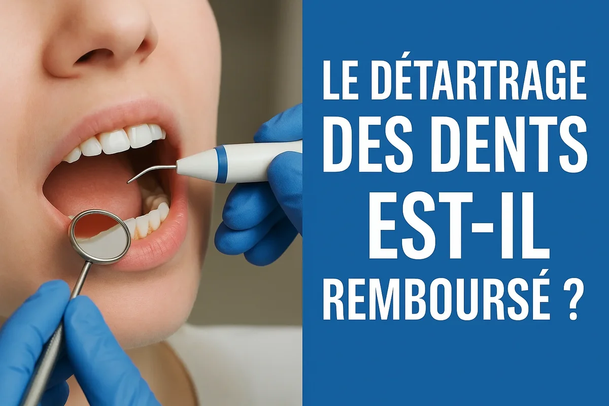 Pourquoi le détartrage est-il essentiel pour la santé bucco-dentaire ? 5 le détartrage des dents est il remboursé
