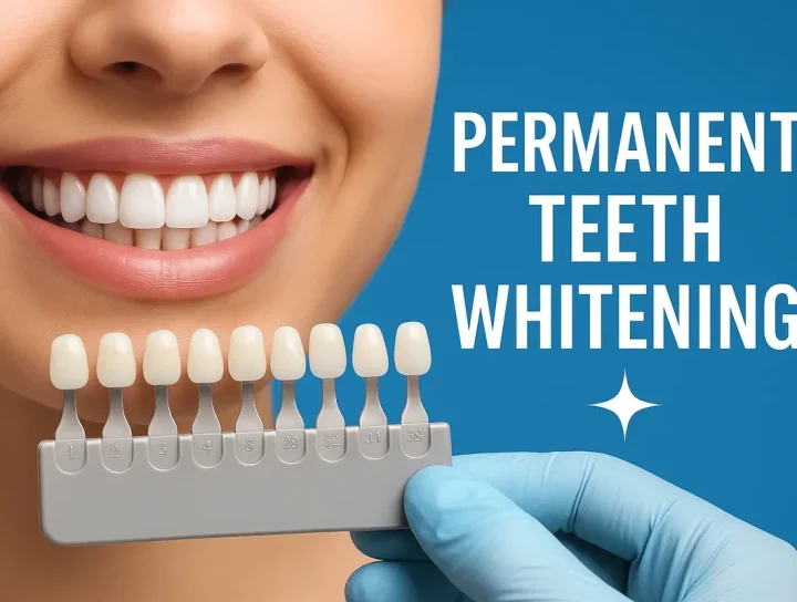 Permanent Teeth Whitening: 7 Proven Ways to a Brighter Smile 4 permanent teeth whitening