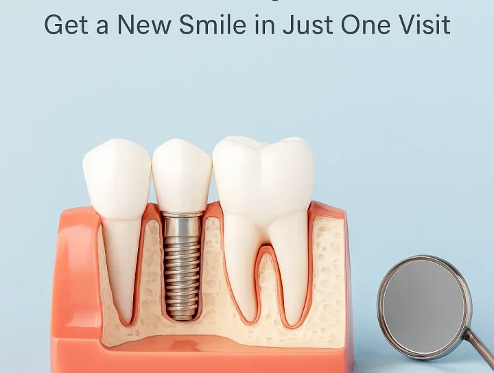 Same Day Teeth: Everything You Need to Know in 2025 8 same day teeth