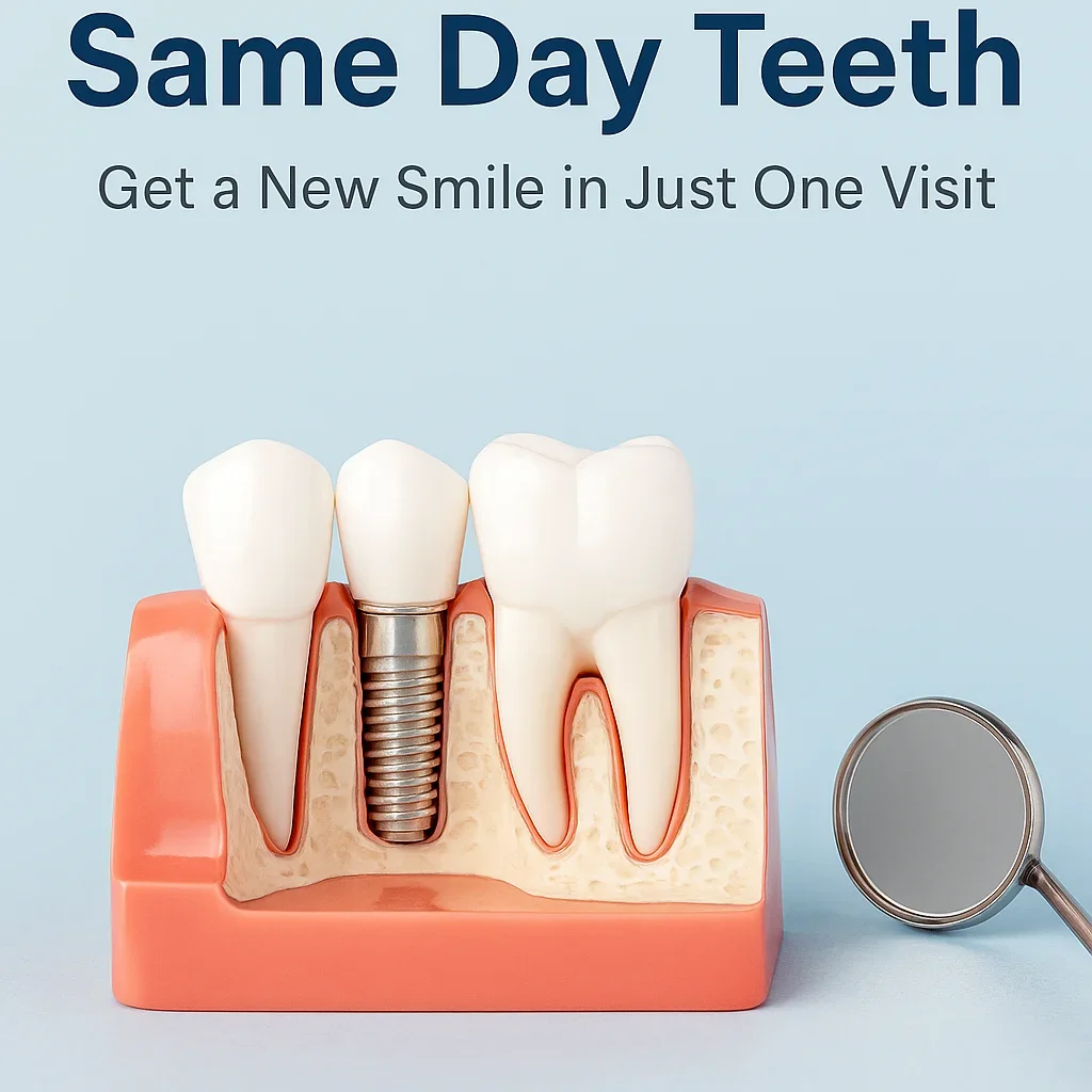 Same Day Teeth: Everything You Need to Know in 2025 5 same day teeth