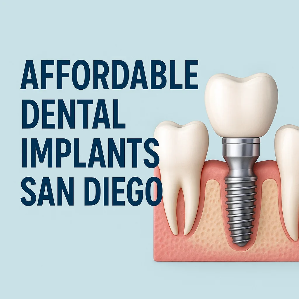 Affordable Dental Implants San Diego 5 affordable dental implants san diego