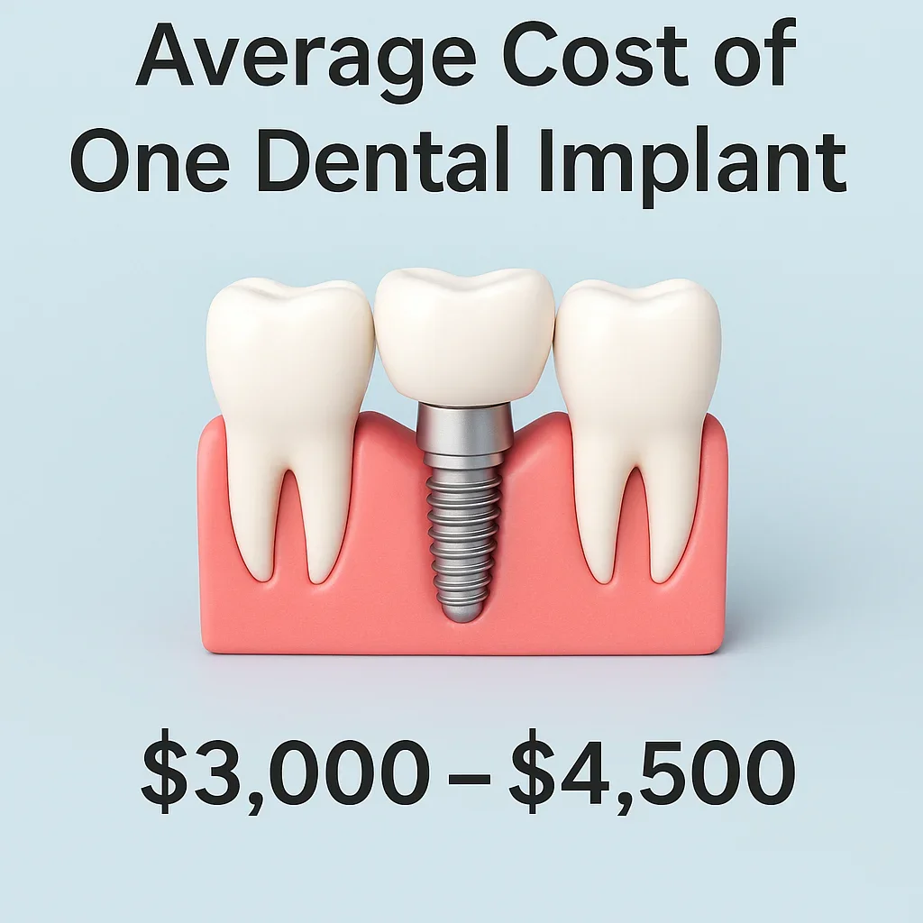 Average Cost of One Dental Implant 5 average cost of one dental implant