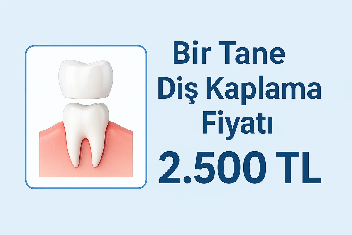 bir tane dis kaplama fiyati