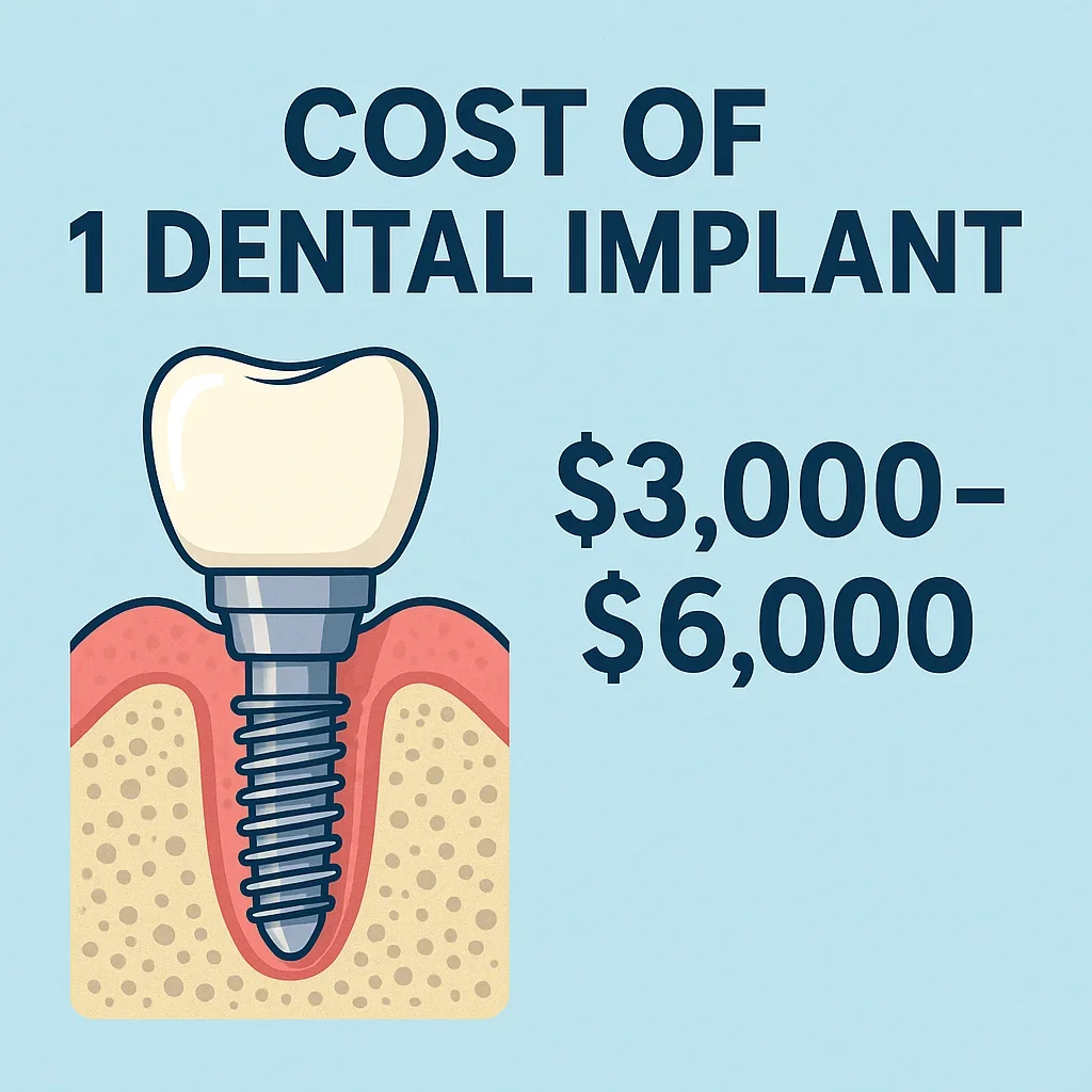 Cost of 1 Dental Implant: Complete 2025 Guide 5 cost of 1 dental implant