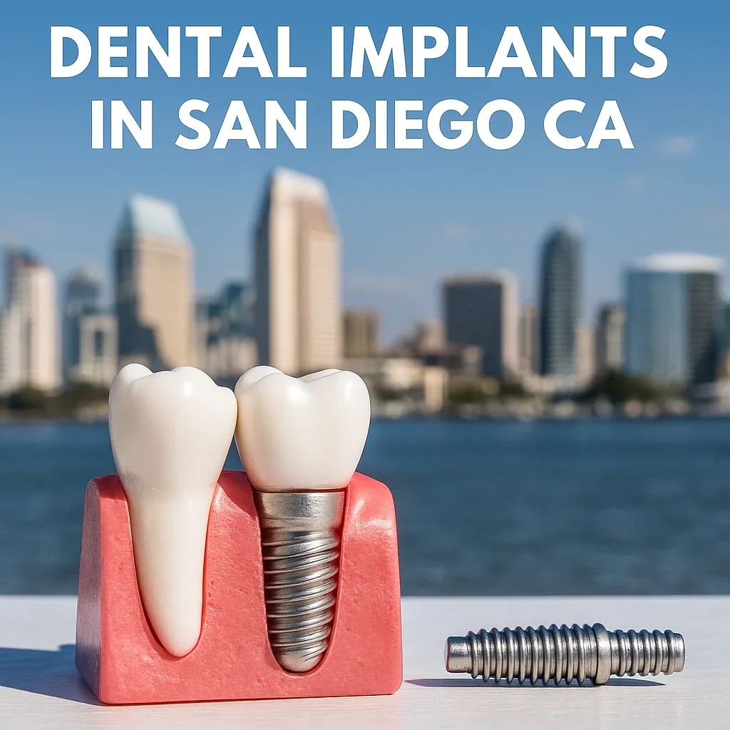 Dental Implants in San Diego CA 5 dental implants in san diego ca