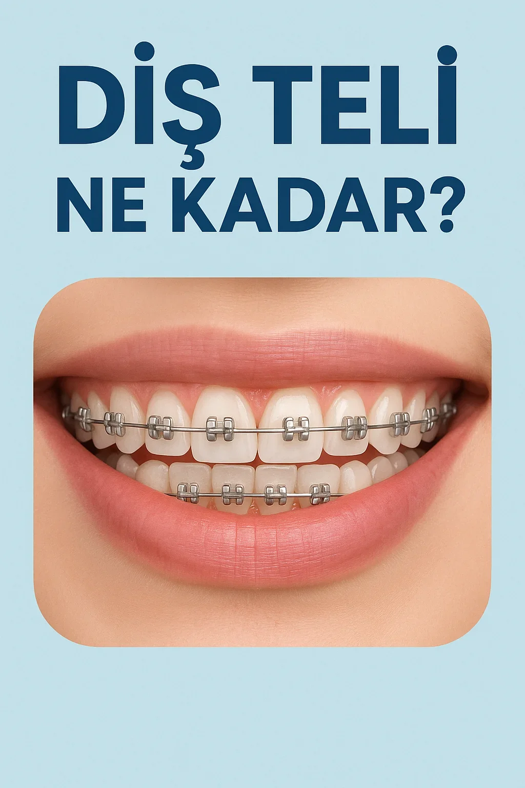 dis tel ne kadar