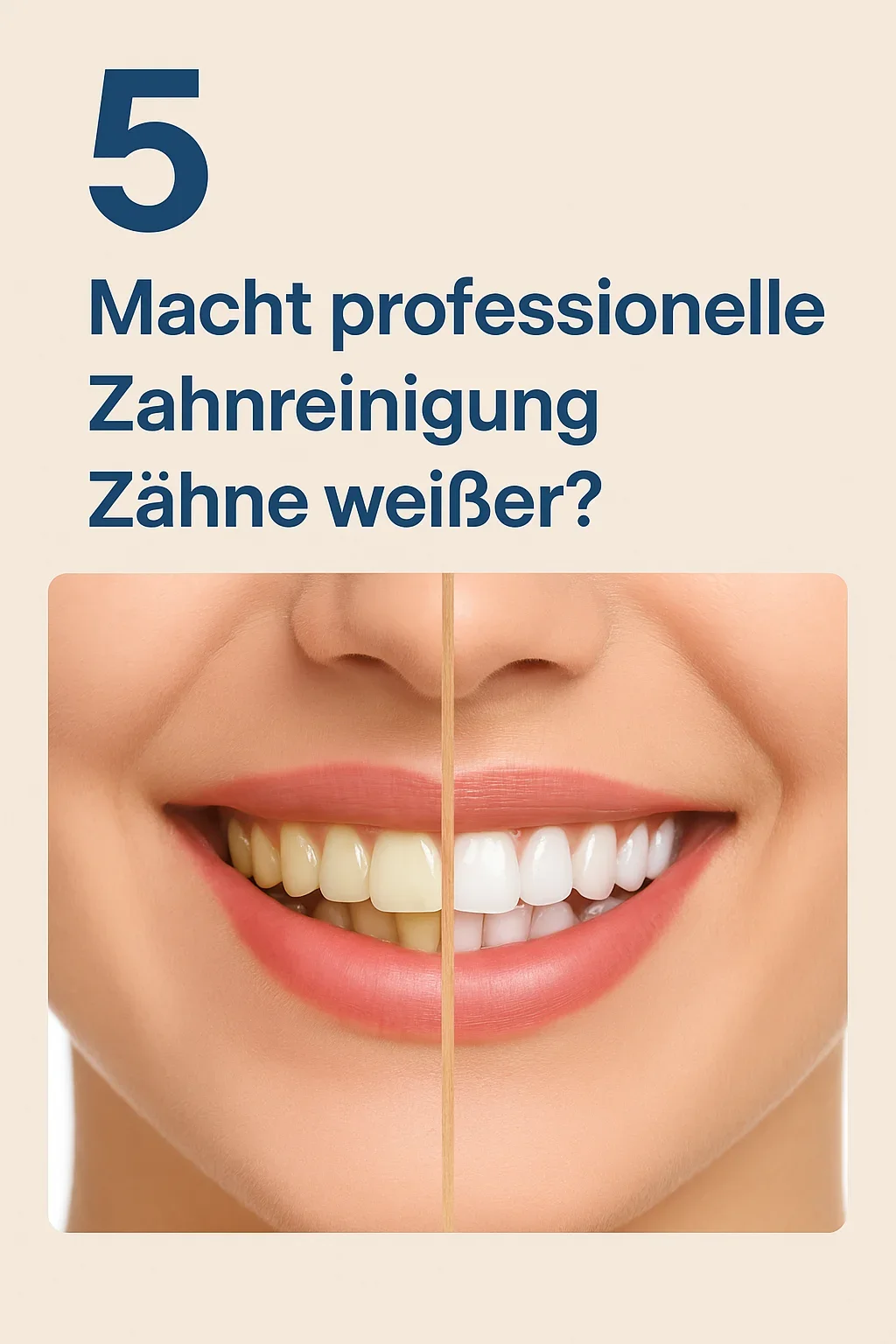 Macht professionelle Zahnreinigung Zähne weißer? 5 macht professionelle zahnreinigung zähne weißer