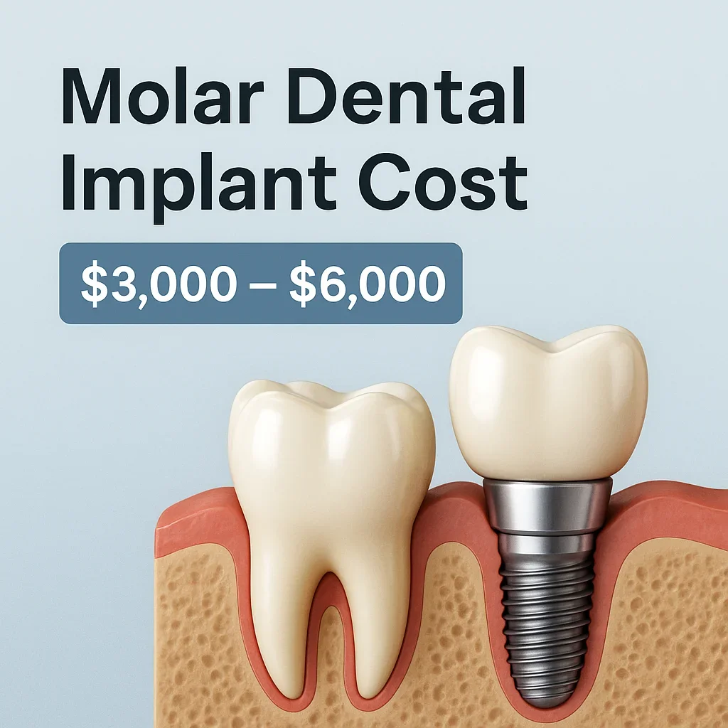 Molar Dental Implant Cost: Everything You Need to Know 5 molar dental implant cost