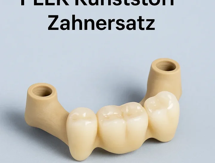 peek kunststoff zahnersatz