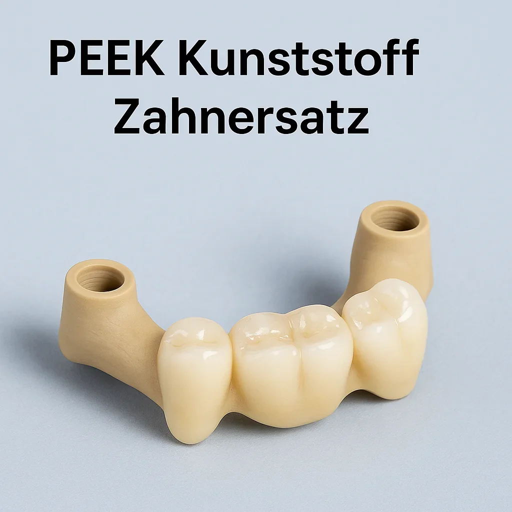 Peek Kunststoff Zahnersatz: Alles, was Sie wissen müssen 5 peek kunststoff zahnersatz