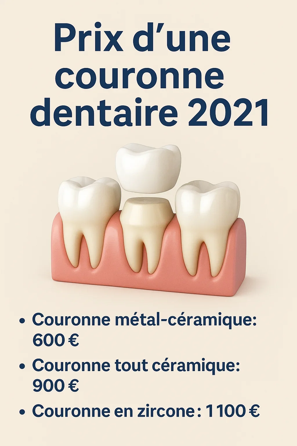 Prix d une couronne dentaire 2021 5 prix d une couronne dentaire 2021
