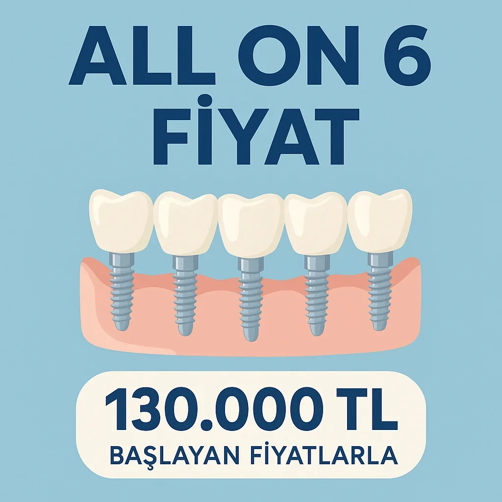 All on 6 Fiyat 2025: Eksiksiz Diş İmplantı Rehberi 5 all on 6 fiyat