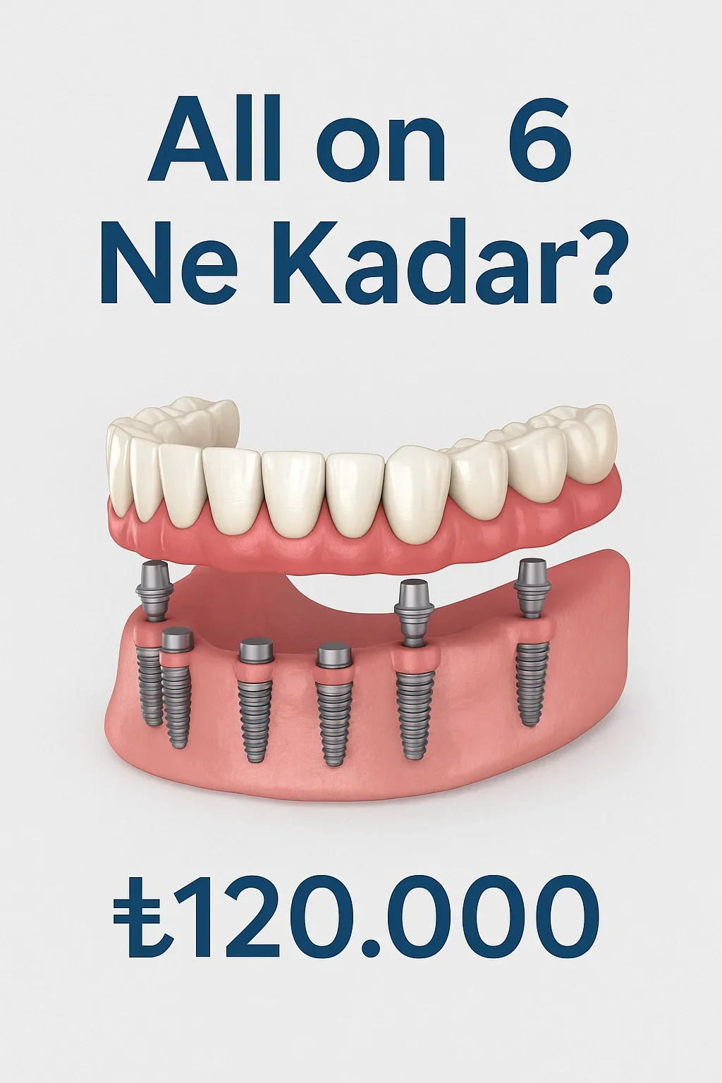 all on 6 ne kadar