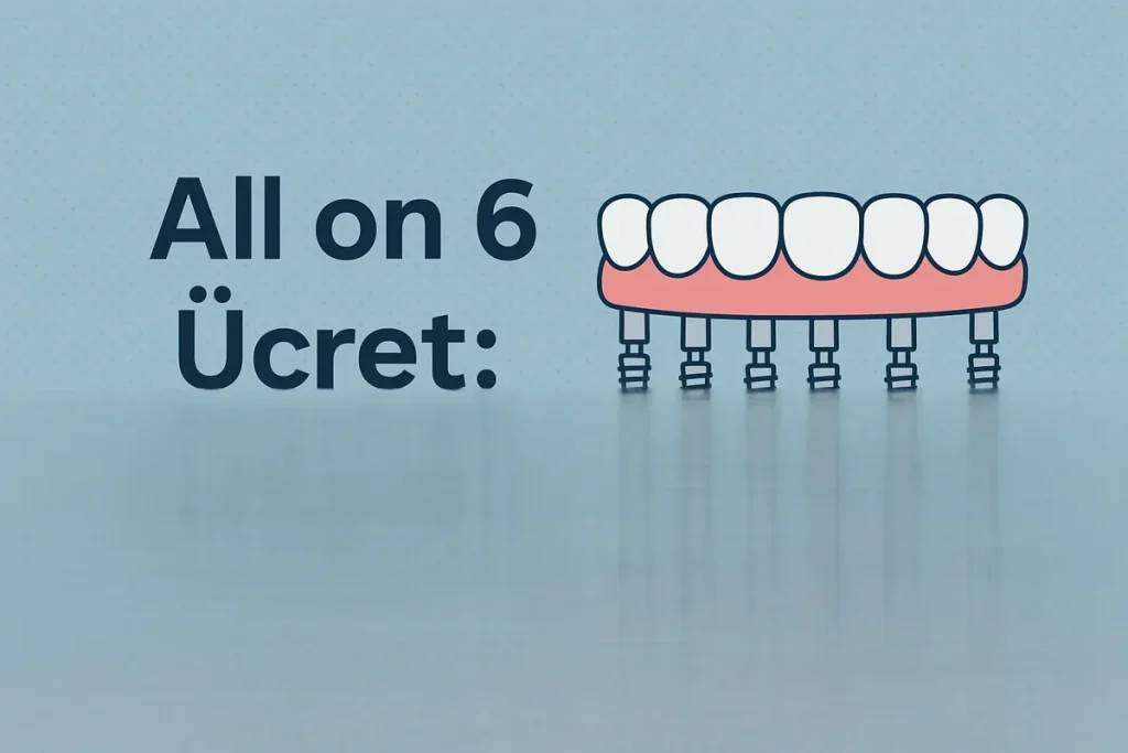 All on 6 Ücret: 2025 Güncel Rehber 4 all on 6 ucret