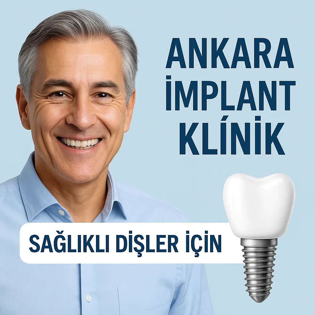 Ankara İmplant Klinik: 2025’in En İyi Diş İmplant Merkezleri 5 ankara implant klinik