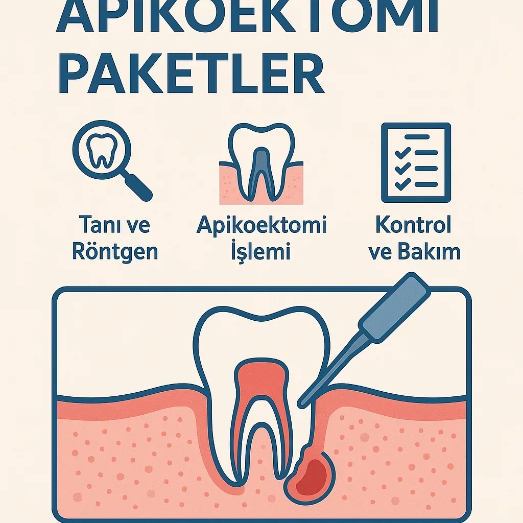 Apikoektomi Paketler Nedir? Diş Kökü Tedavisinde Yeni Dönem 5 apikoektomi paketler