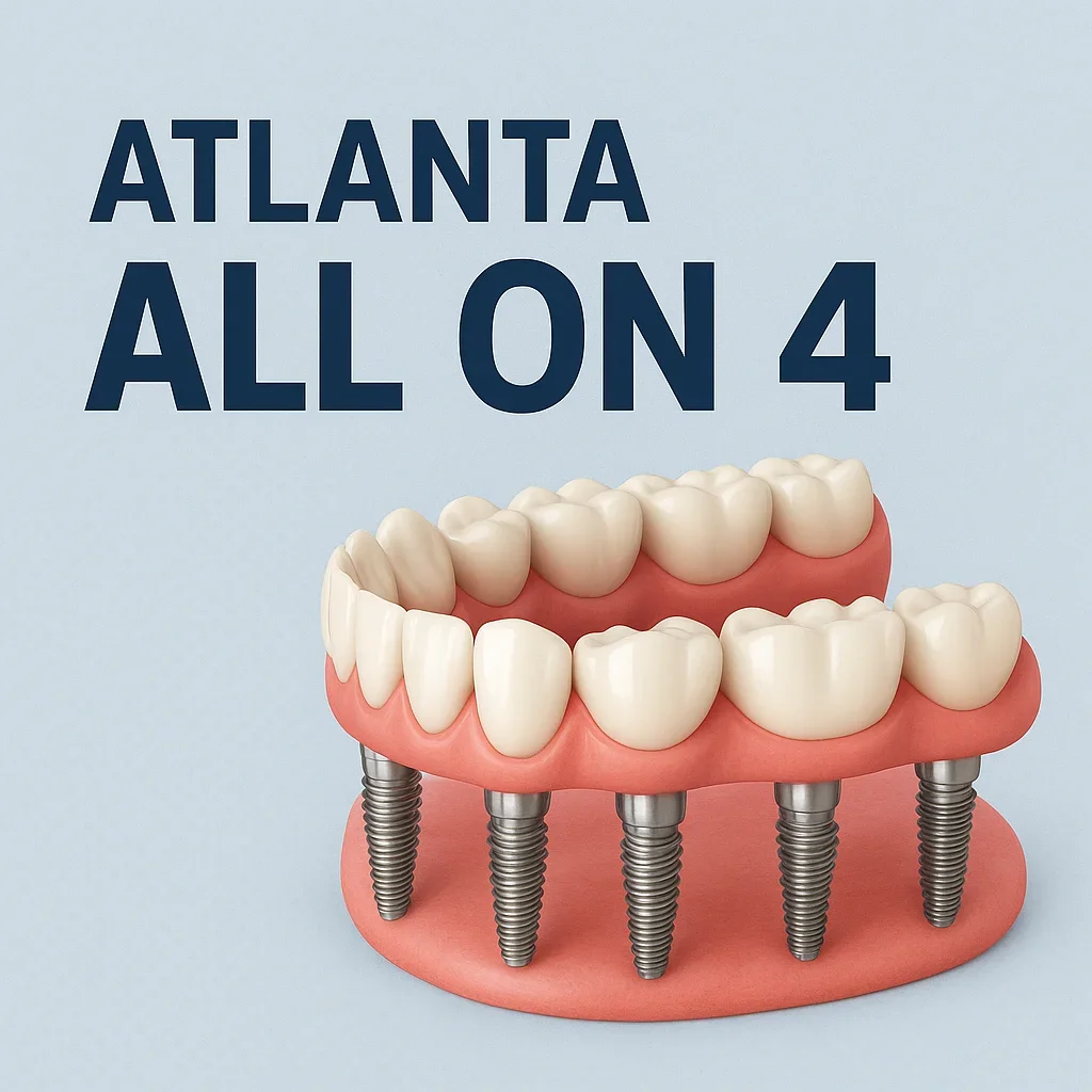 Atlanta All on 4 Dental Implants: The Ultimate Guide 7 atlanta all on 4