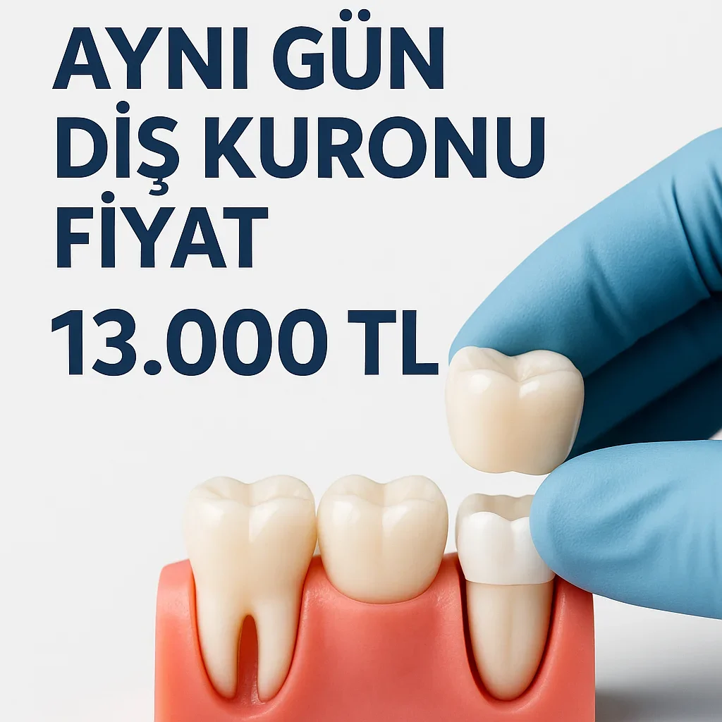 Aynı Gün Diş Kuronu Fiyat 2025: En Hızlı Tedavi Seçenekleri 5 ayni gun dis kuronu fiyat