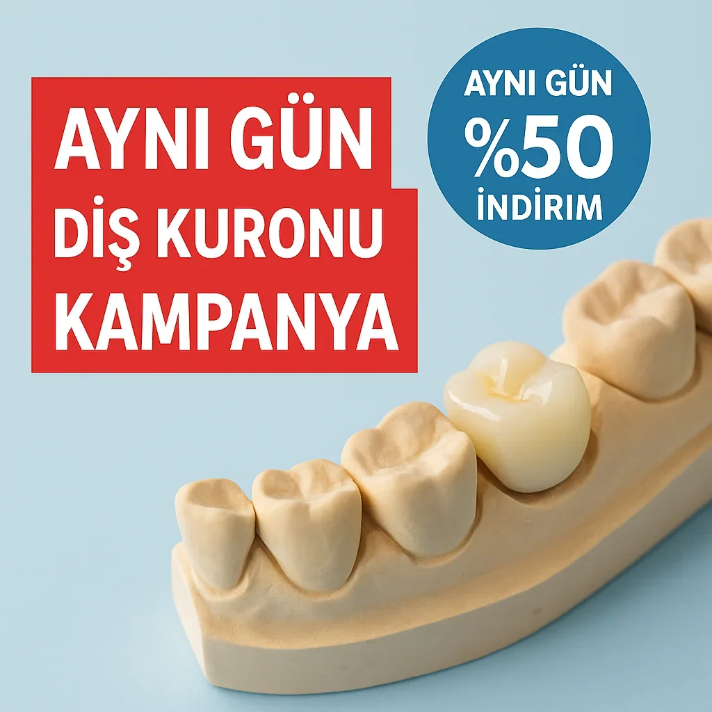 Aynı Gün Diş Kuronu Kampanya: 2025’in En Popüler Diş Tedavisi 5 ayni gun dis kuronu kampanya