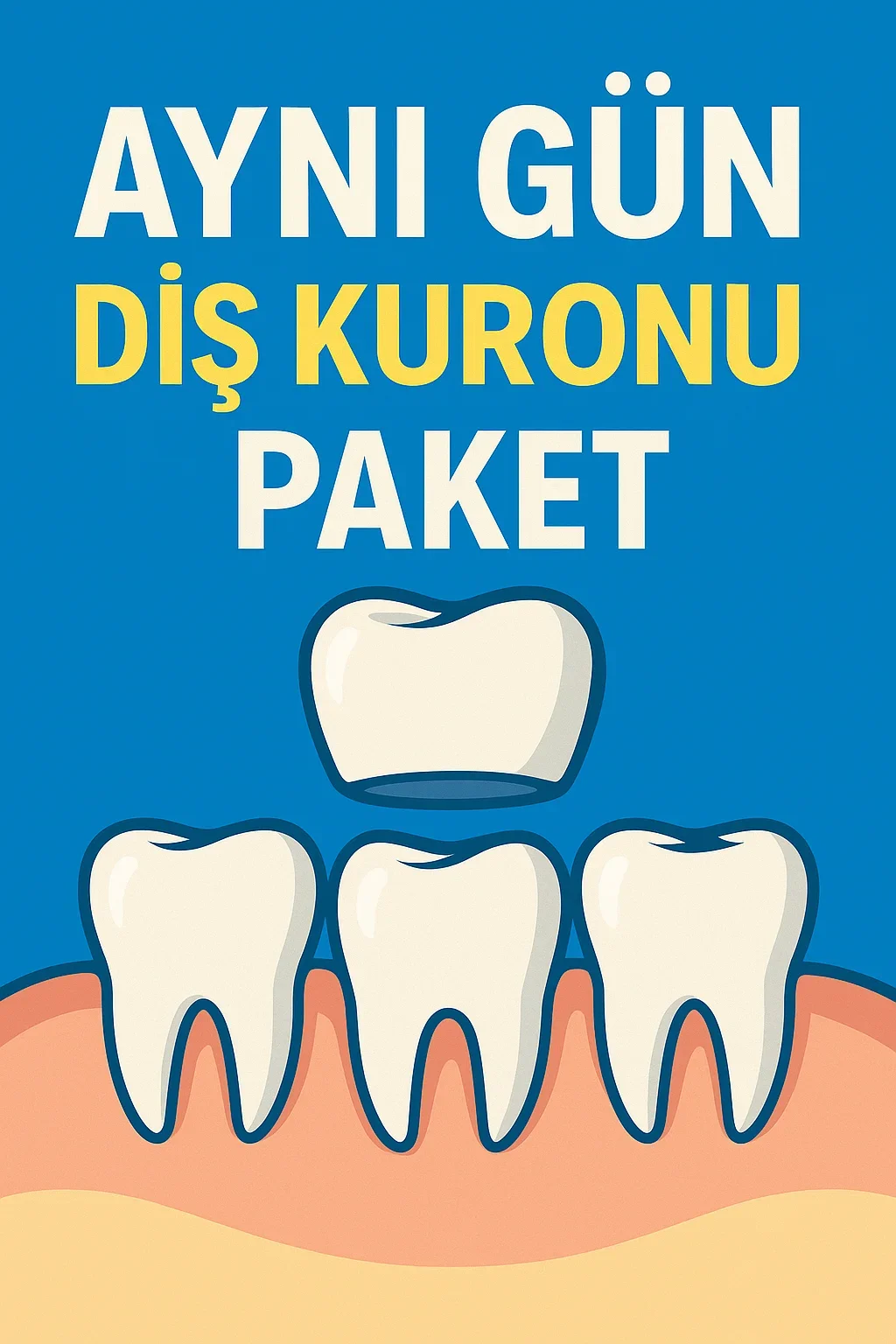 ayni gun dis kuronu paket