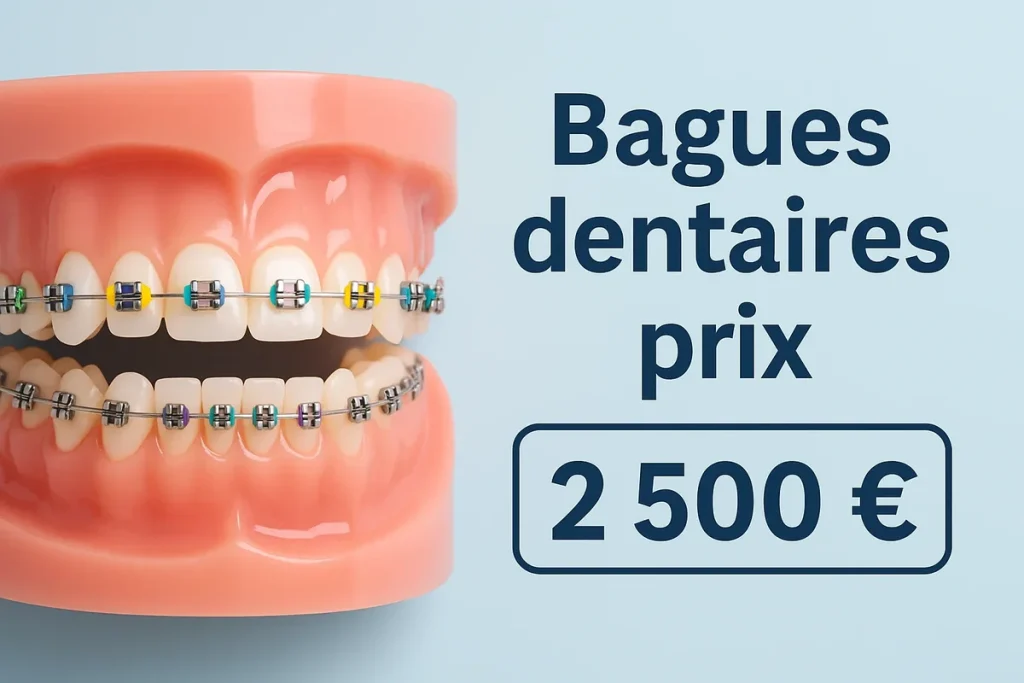 Bagues dentaires prix : tout savoir avant de commencer ! 4 bagues dentaires prix
