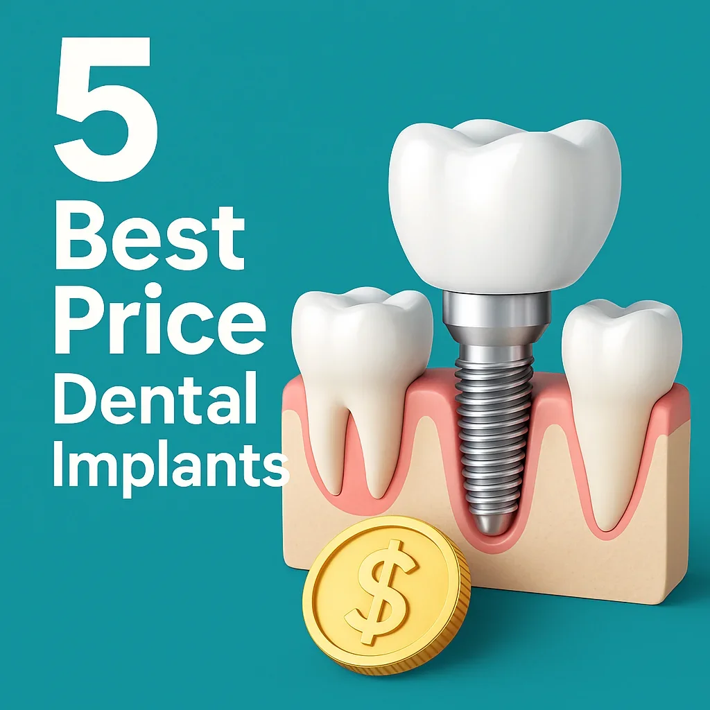 Best Price Dental Implants – Affordable Smile Restoration in 2025 5 best price dental implants