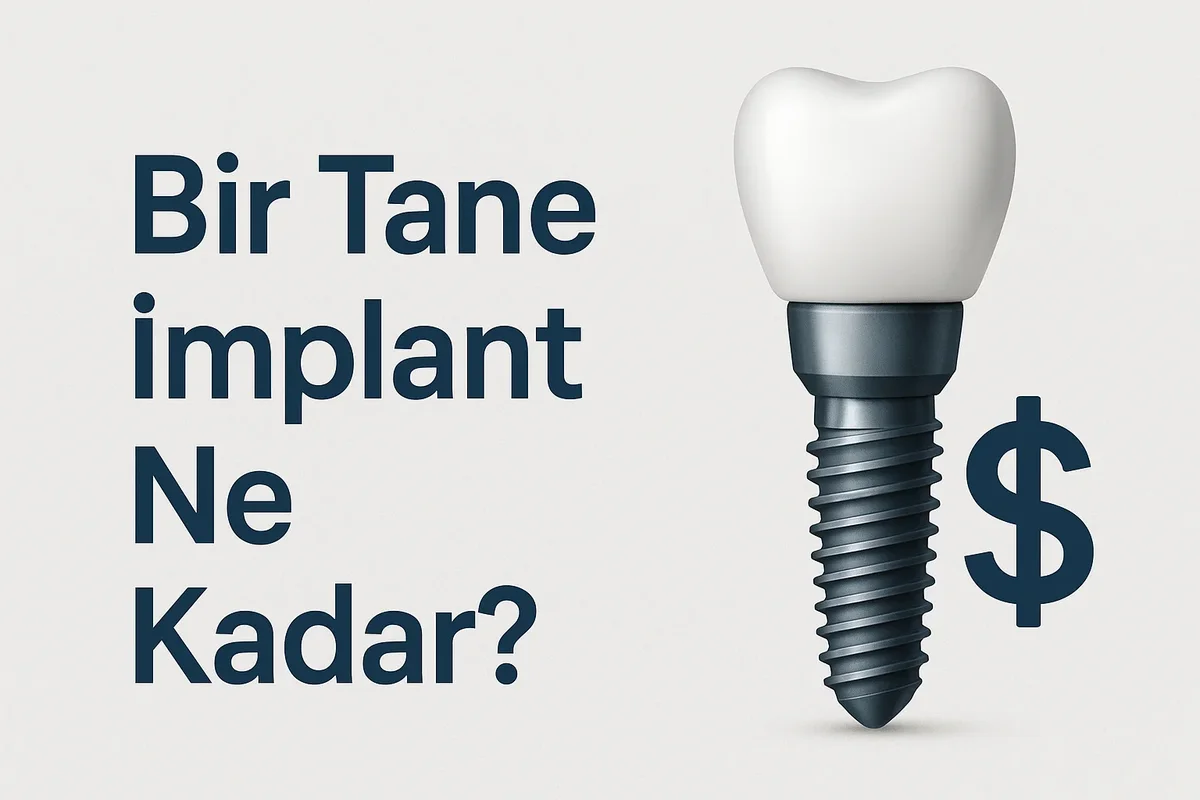 Bir Tane İmplant Ne Kadar? 2025 Güncel Fiyat Rehberi 5 bir tane implant ne kadar